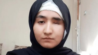 17岁的阿富汗少女阿米里在一场自杀攻击不幸失去一只眼睛，但这没有阻止她继续升学的决心。（图取自BBC）
