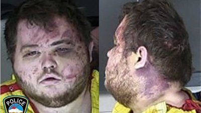 美国科罗拉多斯普林斯警察局周三发布同志夜店Club Q枪击案嫌犯奥尔德里奇的照片，他的面部明显受伤。（图取自科罗拉多斯普林斯警察局/法新社）