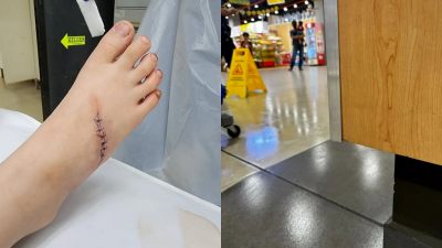 9岁小女孩商场骑乘儿童电动车，不幸被锋利广告牌边缘（右图）割伤，缝了10针。