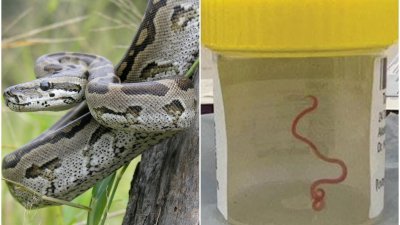 澳洲堪培拉医院从一名妇女的脑中，取出了一条通常在蟒蛇身上发现的蛔虫，长达8公分。（图取自路透社、网络）