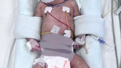 
疑遭遗弃的男婴目前在新生儿童重症监护室接受治疗。