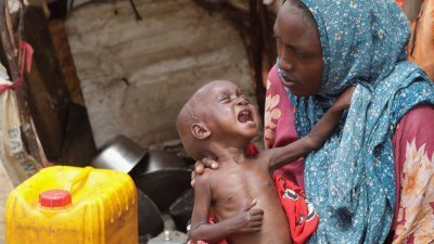 据联合国儿童基金会统计数据，索马里每分钟都有一名儿童，因营养不良而接受治疗。（图取自路透社）