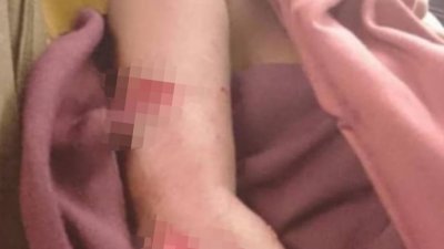 霹雳野生动物局澄清男孩是遭子所伤，并非老虎，且非发生在霹州。（图取自网络）