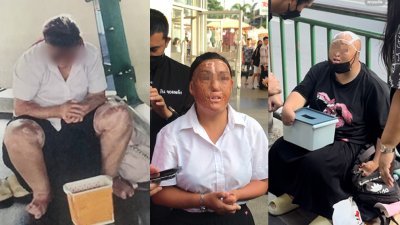 泰国曼谷近日出现多名身穿泰国学生制服、面部遭烫伤且手遭截肢的中国人在街头乞讨，引起泰国政府重视。（图取自Khaosod English）