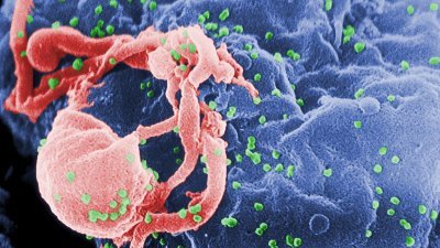 截至上周，柔佛共有6名年龄介于13岁至19岁青少年感染新型爱滋病病毒（HIV）。