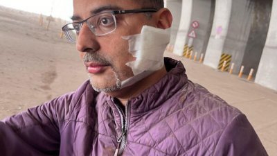 南利塔丈夫的脸颊在地震中被石头划伤。 