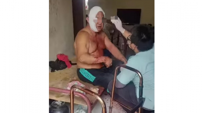 网传视频显示老翁被劫匪攻击后，头部受伤。