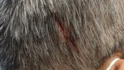 78岁的梁振利头被砍一刀。（8视界新闻）