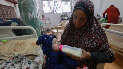 在加沙地带南部拉法的一家医疗中心，一名营养不良的巴勒斯坦儿童周二接受治疗。（图取自法新社）
