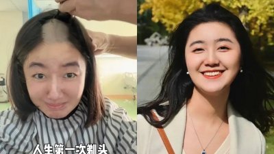 高君雨因罹患罕见脑瘤，传出本月1日接受开颅手术，同时分享许多影片，但有网民爆料她去年就已康复。