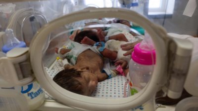 加沙南部拉法的医院里，数名早产儿挤在一个保温箱内接受照顾。（图取自法新社）