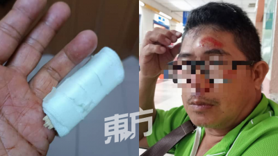 受伤的华裔男事主惨从脚车上摔下，脸部流血，左手指骨折，事后修养2周。
